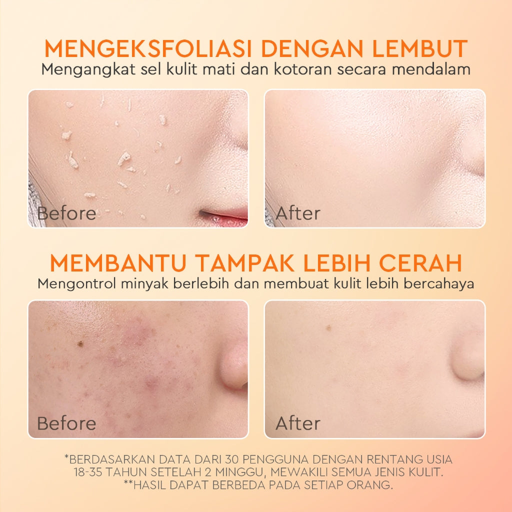 Glad2Glow peeling gel Apricot Glycolic Acid Exfo Smooth Eksfoliasi peeling produk yang mampu mengangkat sel kulit mati  Komedo Kotoran Scrub Wajah Extract g2glow official store