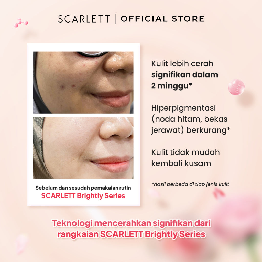 SCARLETT Brightly Ever After Serum - Brightening Serum Mencerahkan Wajah Melembapkan Glowing dan Bebas Kusam dengan Niacinamide dan Phyto Whitening