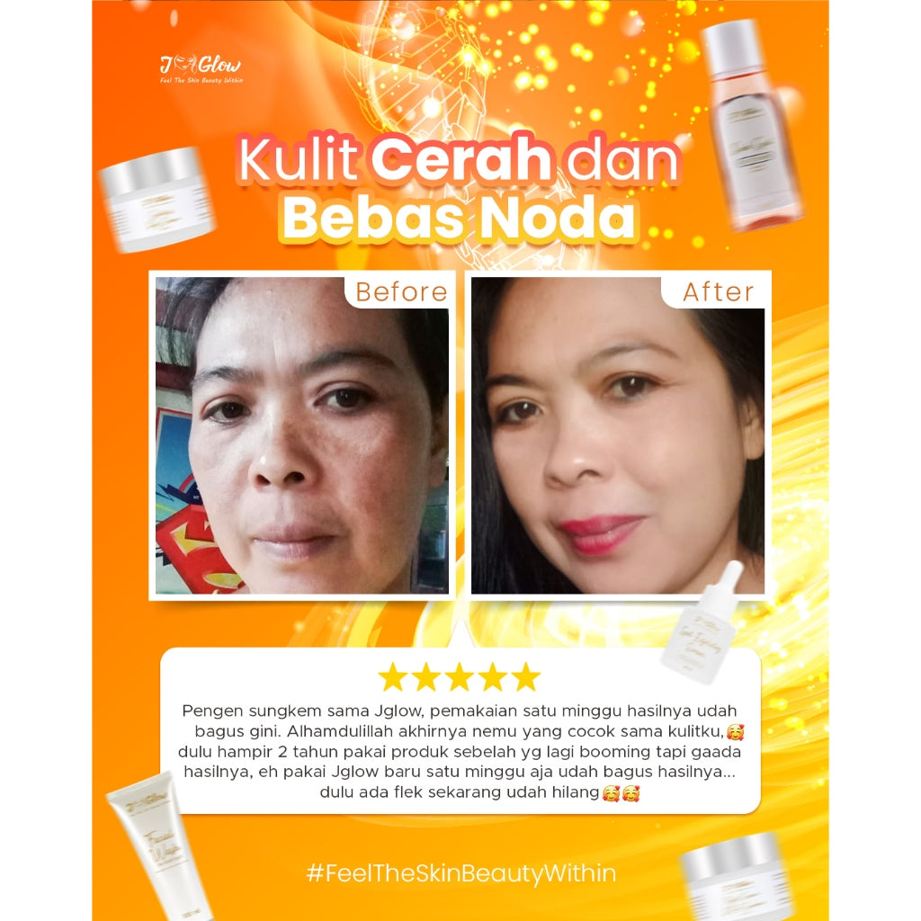 Jglow Skincare Paket Spot Expoliating Serum Perawatan Kulit Wajah Flek Hitam Bpom Original