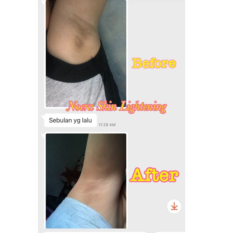Noera Skin Lightening Cream | Brightening Armpit Cream Pemutih Lipatan Pemutih Ketiak Pemutih Selangkangan