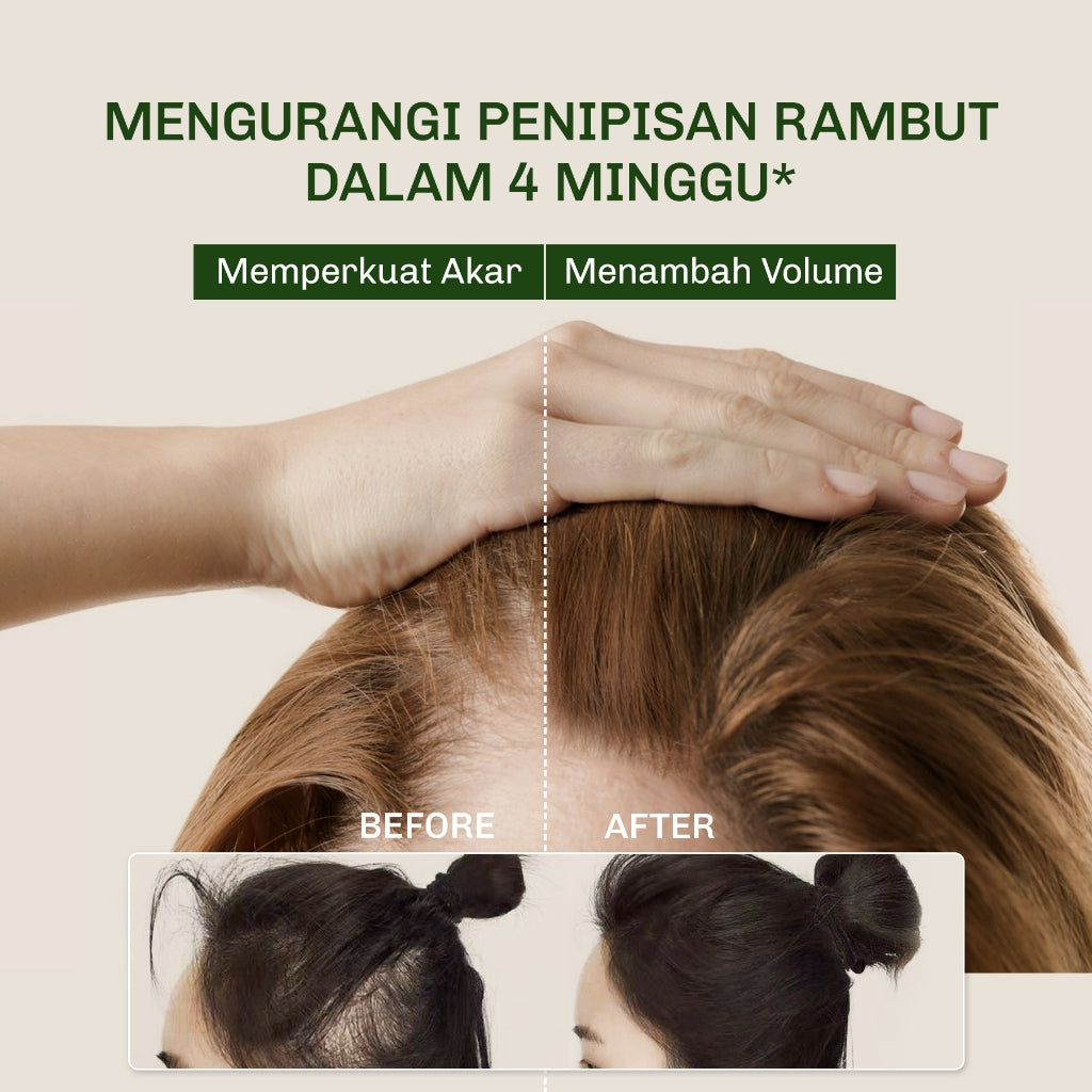 [BUNDLE] Lavojoy Hold Me Tight Pro Shampoo + Scalp Essence Spring Wonder 2in1 Bundle Set | Perawatan Rambut Rontok | Hair Essence | Memperkuat Akar Rambut | Perawatan Rambut Rontok Essence | Hair Tonic | Essence Ginseng & Jahe