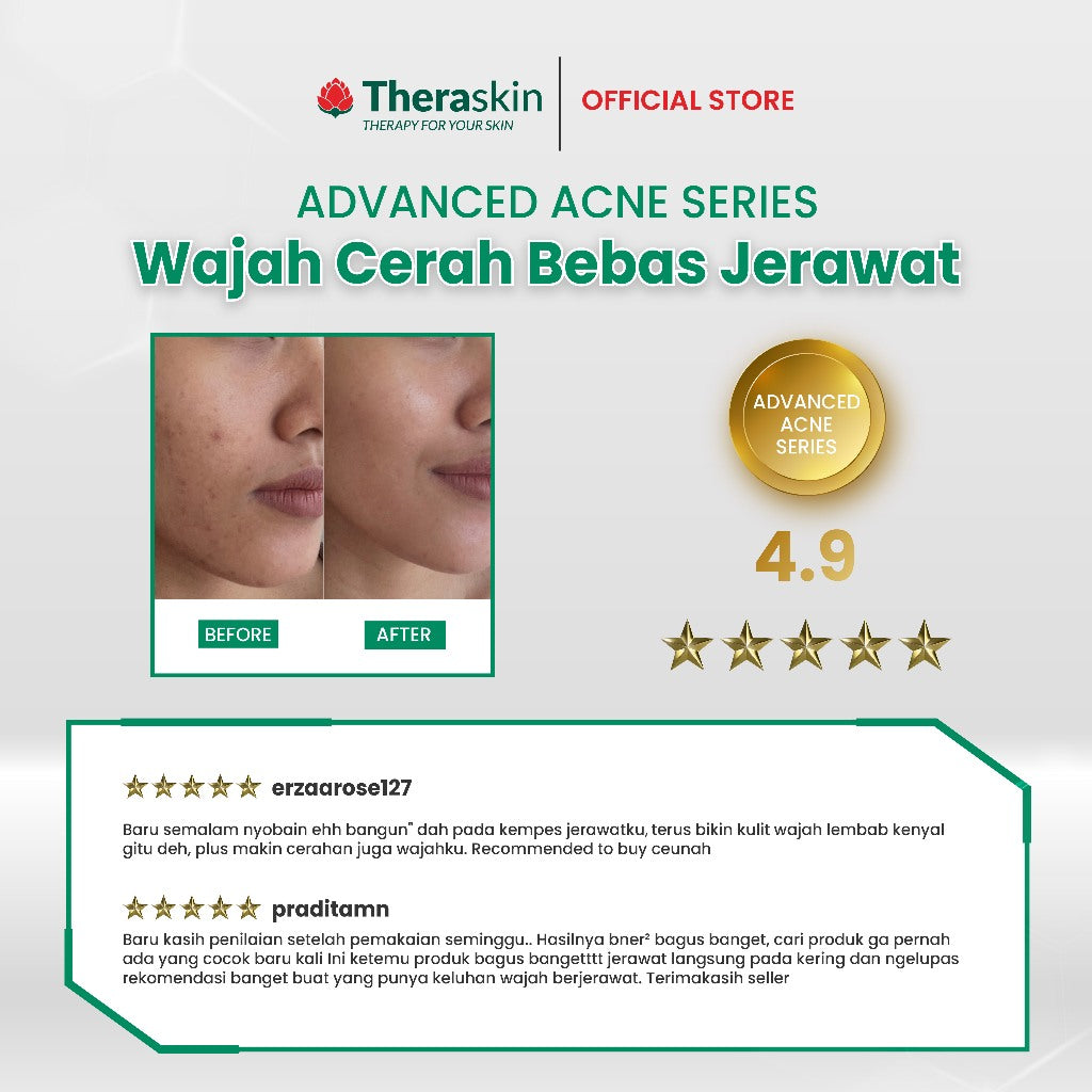 Theraskin BPOM Advanced Acne Series - Paket Perawatan Jerawat 5pcs dengan BHA dan Niacinamide