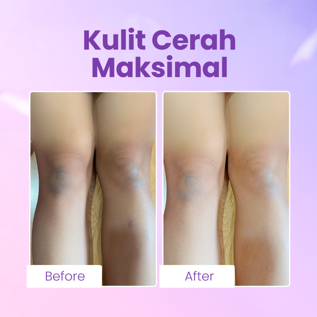 Scarlett Whitening Body Serum ( Happy, Jolly, Charming ) Melembabkan dan Mencerahkan