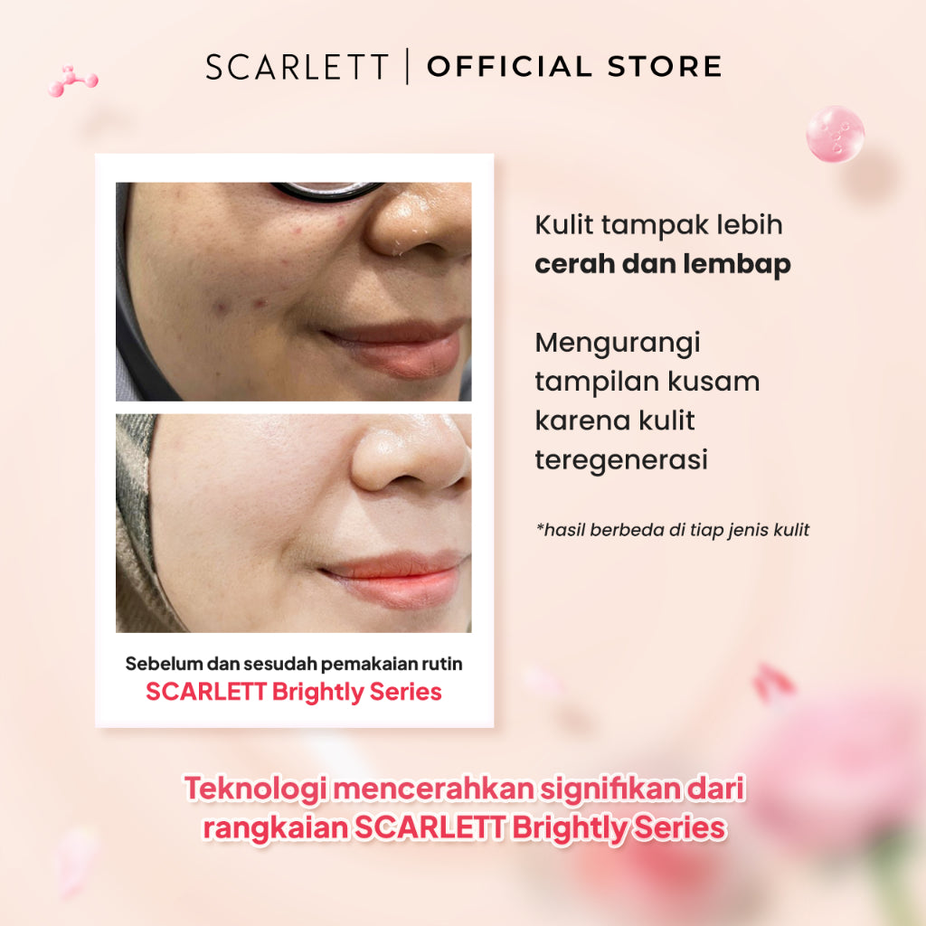 Scarlett Whitening Brightly Ever After Day Cream - Moisturizer Krim Pelembab Wajah untuk Mencerahkan Melembabkan & Memudarkan Noda Hitam di Kulit Wajah dengan Sensasi Menyegarkan || Kombinasi Glutathione & Niacinamide sebagai Pemutih Wajah