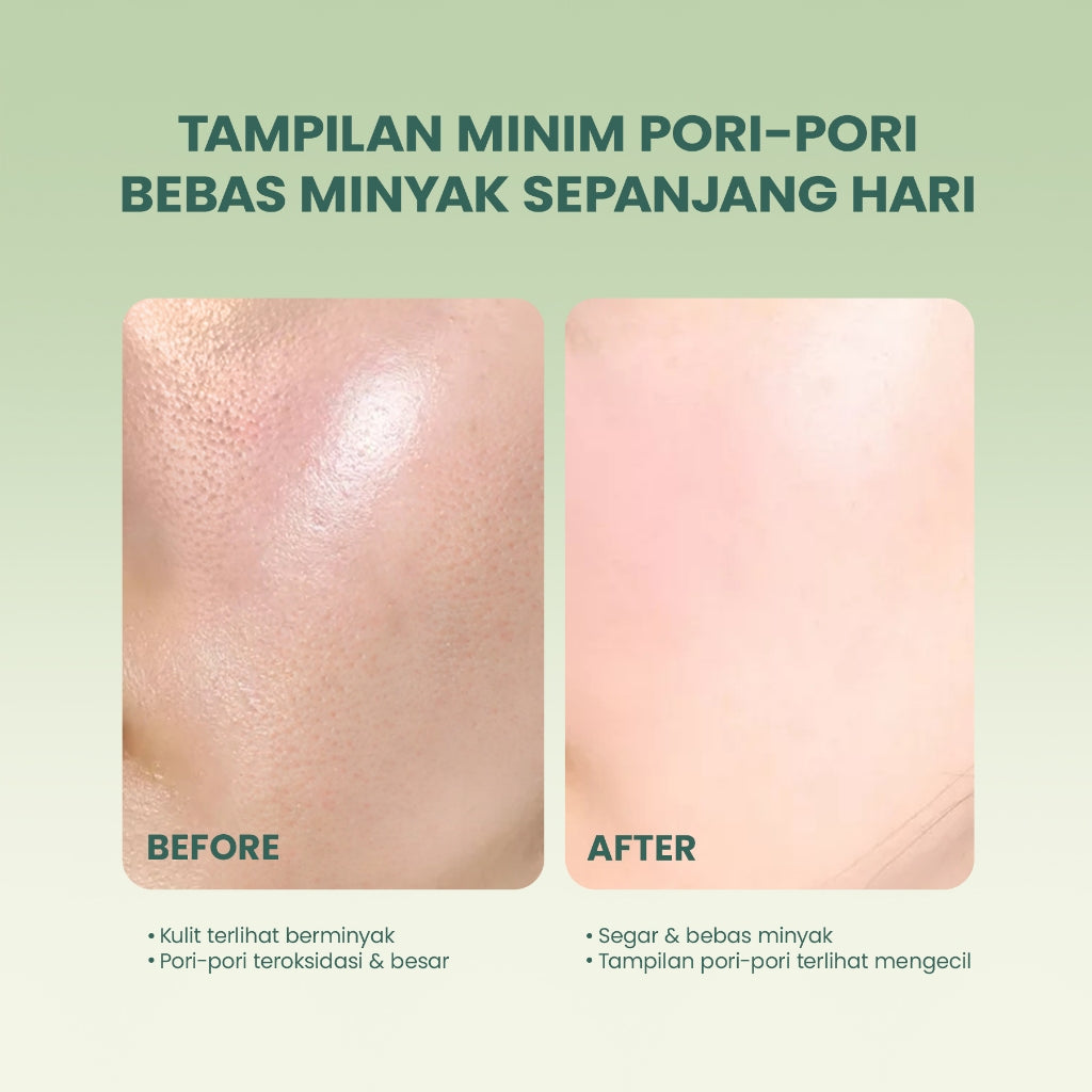 YOU AcnePlus AHA BHA PHA Daily Essence Toner Kulit Berminyak Jerawat Centella dan Oil Control