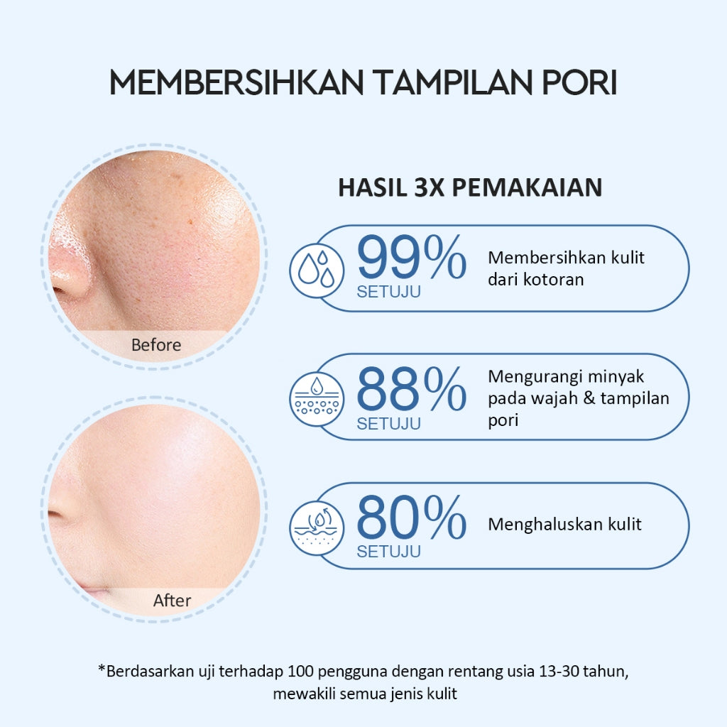 Glad2Glow Volcano 3D Acid Pore Clay Mask Masker Wajah Masker Glad2Glow Masker Komedo Dan Pori Pori Wajah Deep Pores Cleansing Masker Organik Clay Mask Clay Masker Mud Mask Face Masker Jelly Mask Sheetmask Wash Off Mask Masker Jerawat G2Glow Official Store