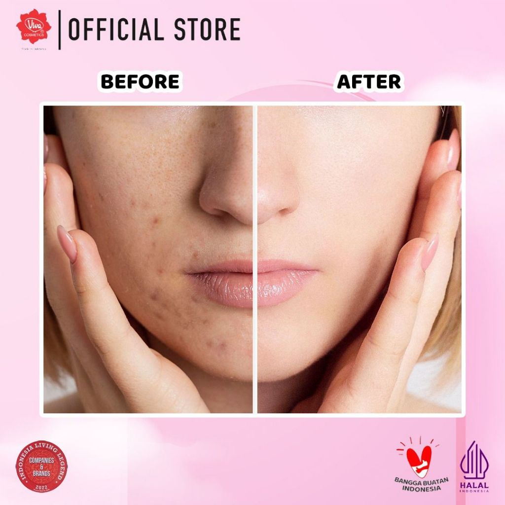 [PROMO] Paket Anti Dark Spot Set with Niacinamide, Glutathione, & SPF 30 PA+++