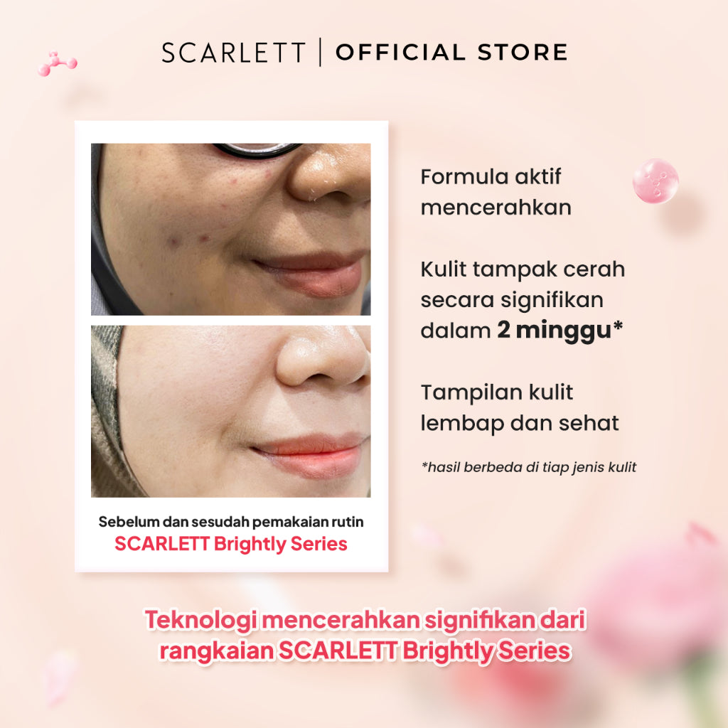SCARLETT Brightly Ever After Series - Paket Lengkap Mencerahkan Wajah 5in1-Brightening Moisturizer +Serum+Cleanser+Toner+Krim Pagi+Krim Malam | Niacinamide Vitamin C Gluthatione
