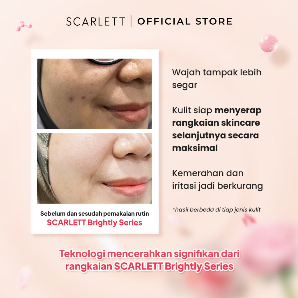 Scarlett Whitening Brightly Essence Toner - Toner Wajah untuk Mencerahkan Melembabkan & Memudarkan Noda Hitam di Kulit Wajah dengan Sensasi Menyegarkan || Kombinasi Glutathione & Vitamin C sebagai Pemutih Wajah