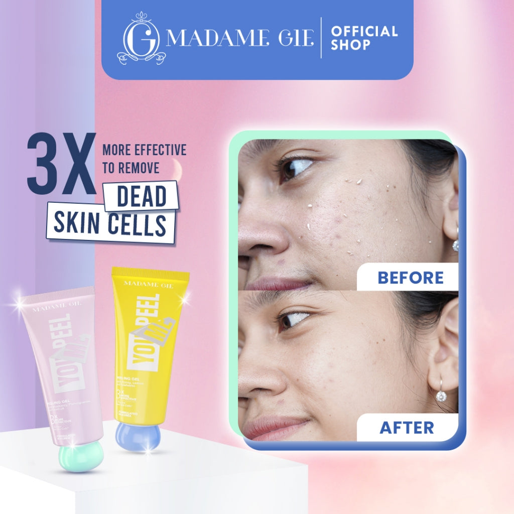 3X Madame Gie Madame You Peel Me - Peeling Gel