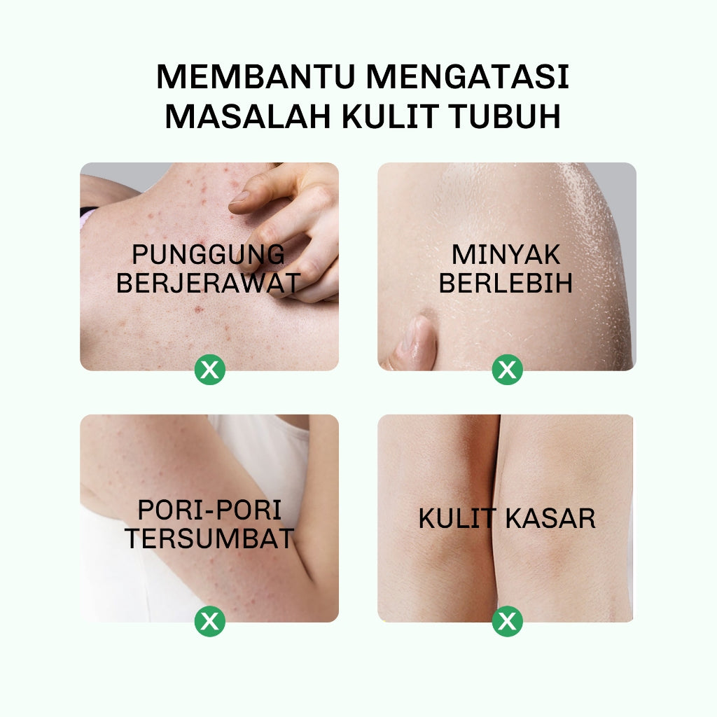Lavojoy Solve It Now Body Wash | Sabun Mandi Cair Untuk Melembabkan Kulit Sensitif,  Merawat Kulit Berjerawat Dan Menghaluskan Tekstur Kulit Kasar | Mengandung Amino Acid, AHA, BHA Dan Zinc PCA