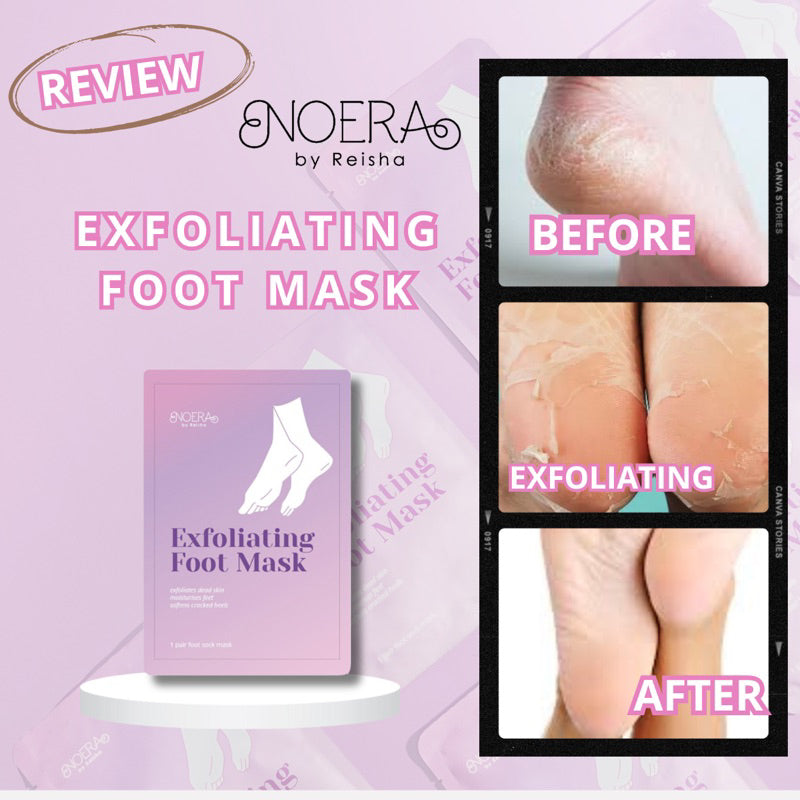 Noera Exfoliating Foot Mask | Masker Kaki Remove Pengelupas Kulit Mati | Peeling Foot Mask