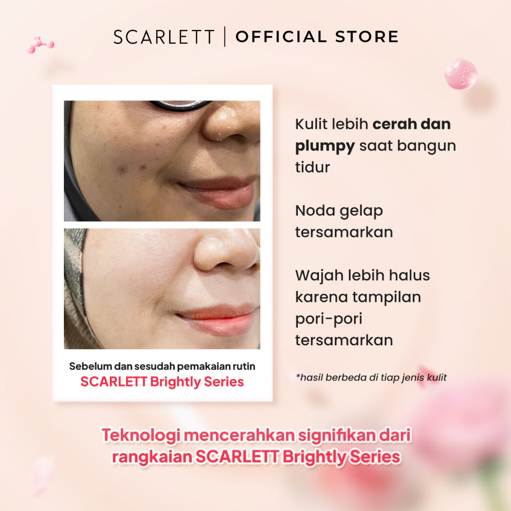 Scarlett Whitening Brightly Ever After Night Cream - Moisturizer Krim Pelembab Wajah untuk Mencerahkan Melembabkan & Memudarkan Noda Hitam di Kulit Wajah dengan Sensasi Menyegarkan || Kombinasi Licorice Extract & Niacinamide sebagai Pemutih Wajah