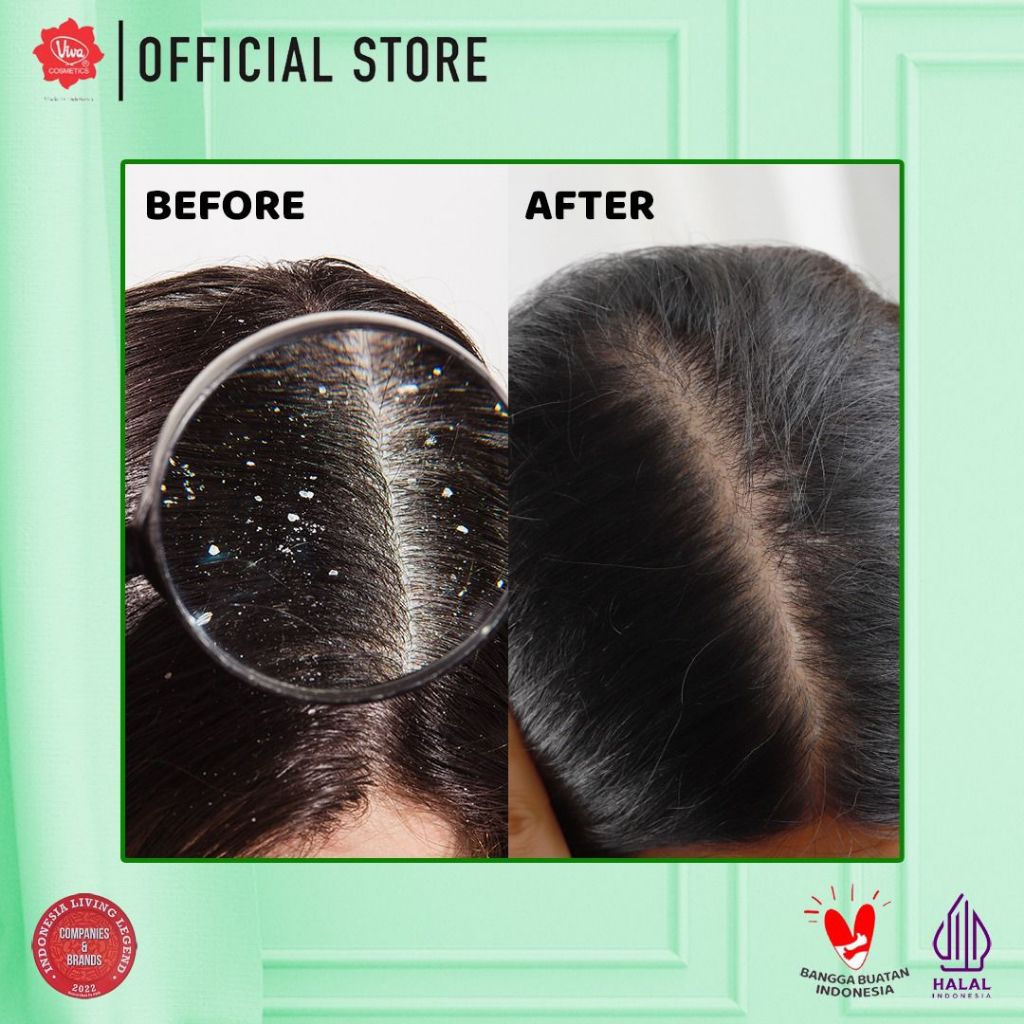 [PROMO] Paket Fresh Hair with Collagen - INTENSE ANTI DANDRUFF HAIR CARE (isi 3 item)