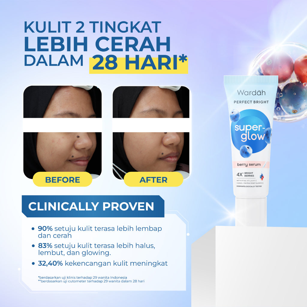 WARDAH 4X Vitamin B3 with Hyaluronic Acid Perfect Bright Super-Glow Berry Serum 8 ml - Serum Mencerahkan, Menutrisi Kulit, Meratakan Warna Kulit Kusam, Menyamarkan Bekas Jerawat - Kulit Cerah, Tampak Sehat, Supple, Glowing - Skincare