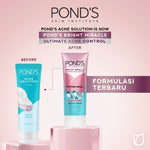 Pond's Bright Miracle Ultimate Acne Control Facial Foam 100G