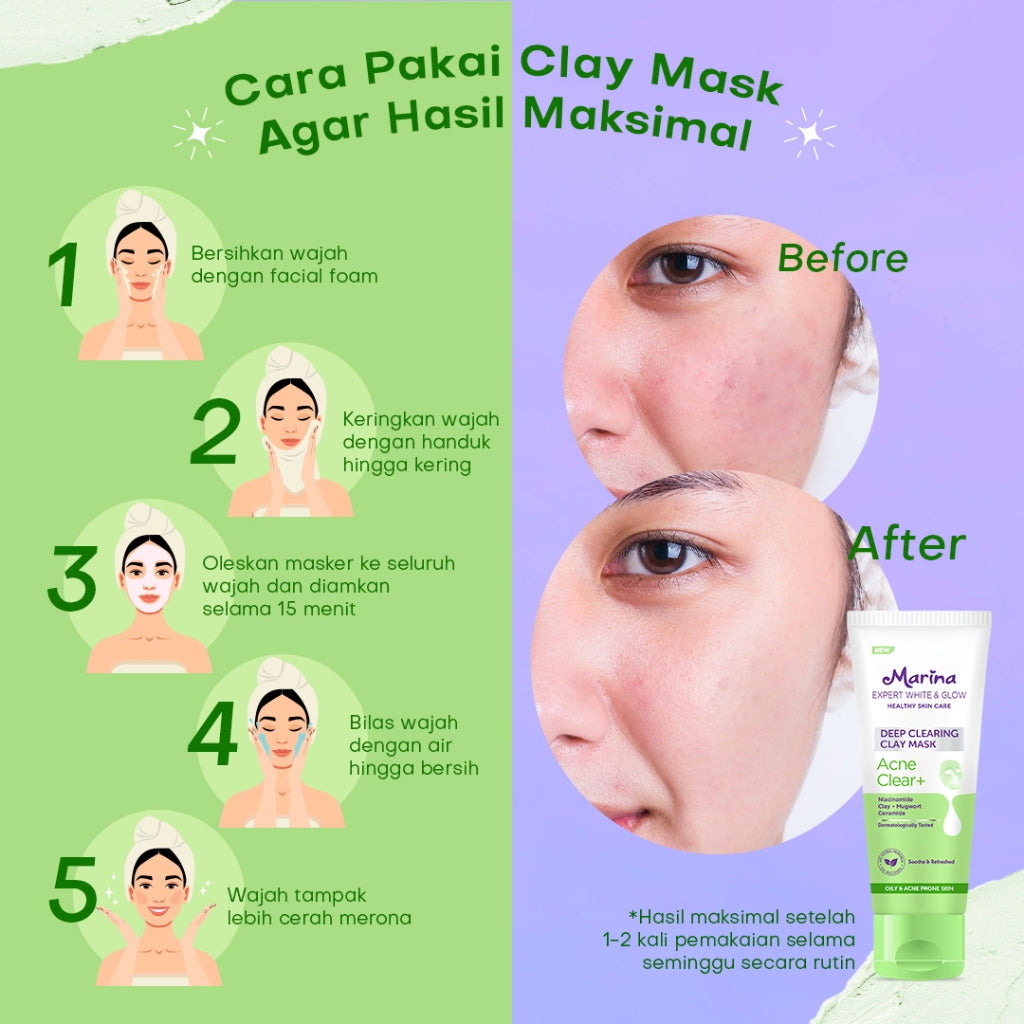 Marina Expert White and Glow Face Mask Acne Clear 50ml [1pcs] - Exp Date : 03.2026
