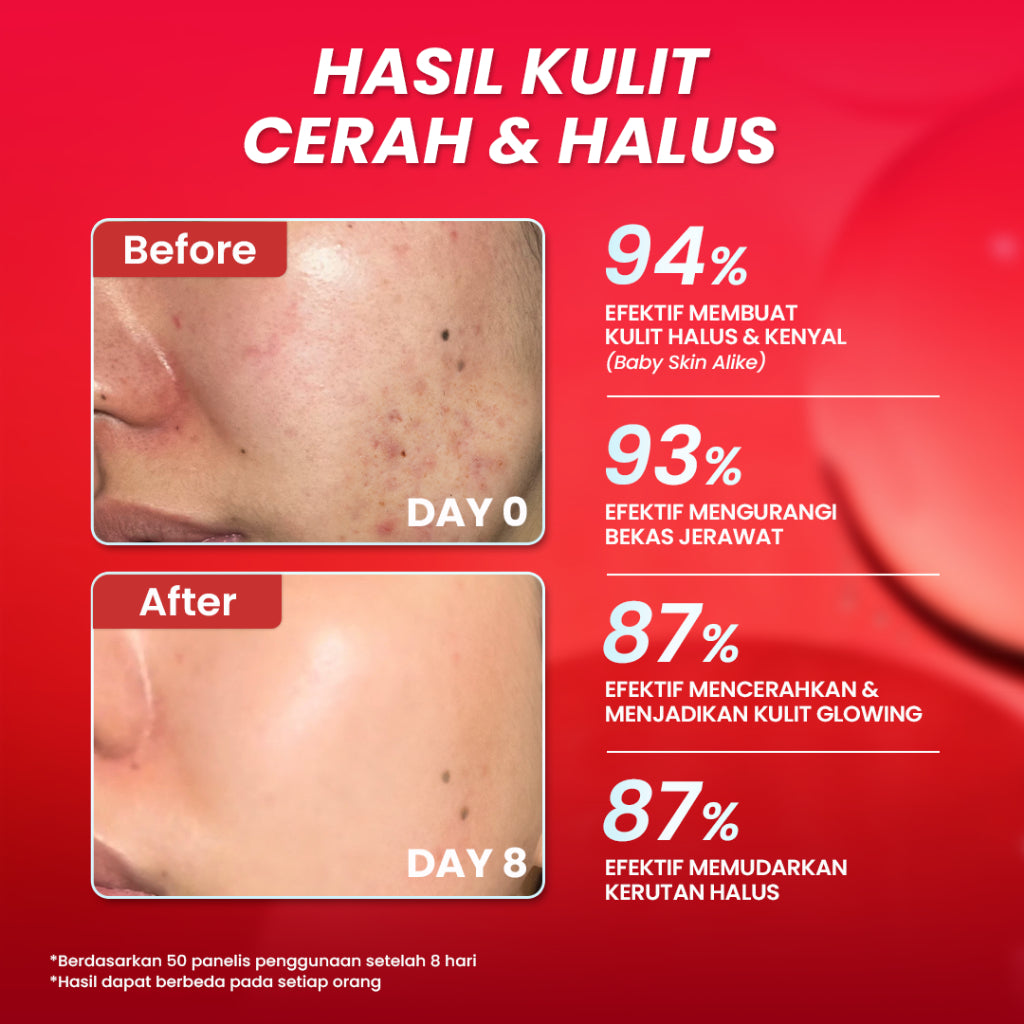 Hanasui Advance Retinol Serum -  Anti Aging Serum untuk Kerutan Halus Tekstur Kulit Cerah Kenyal Encapsulated Retinol, HPR, Advance Niacinamide, 5X Ceramide