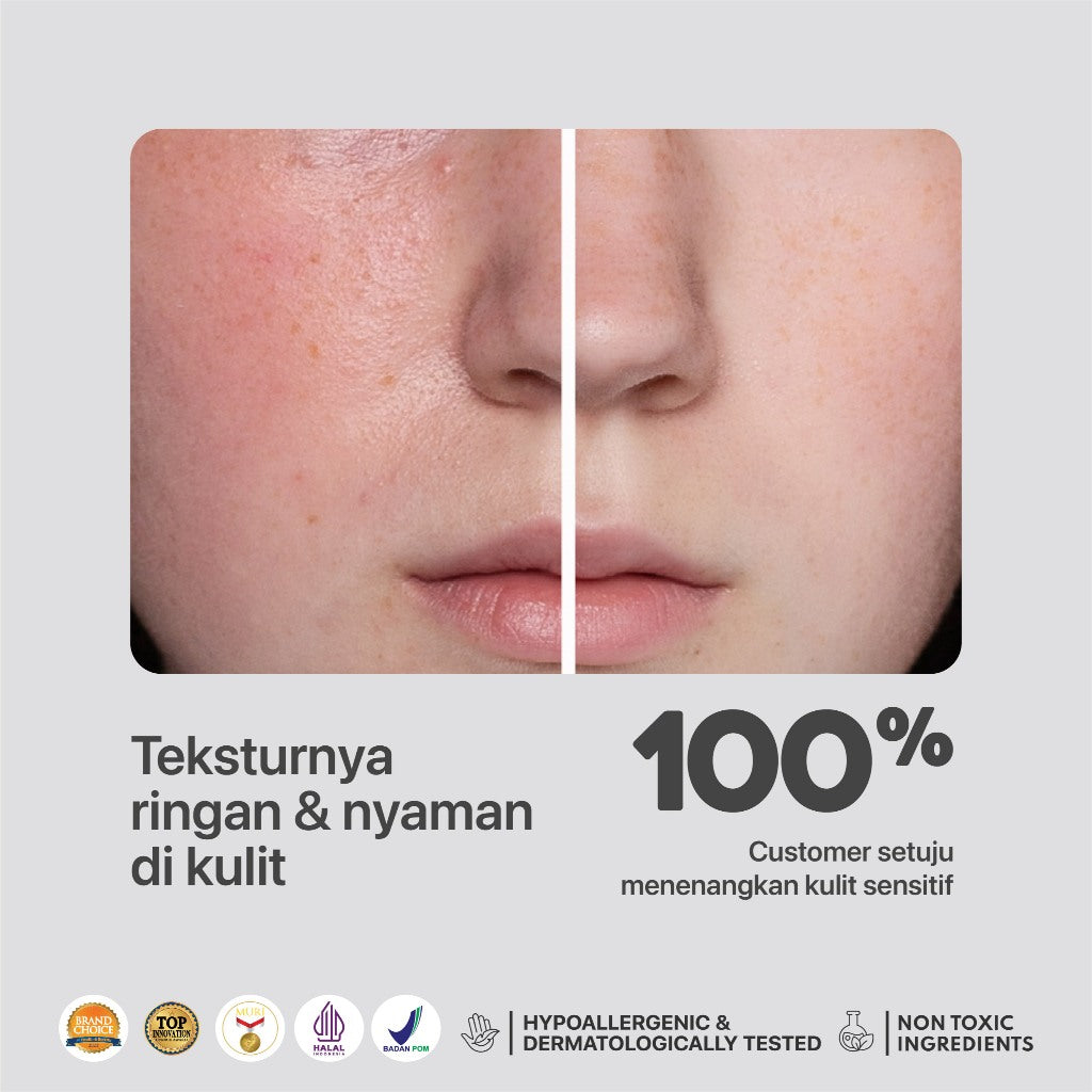 NPURE Toner Noni / Balance Me / Toner Kulit Sensitif Kemerahan / Toner Hypoallergenic / Semua Jenis Kulit / Eczema / Ceramide