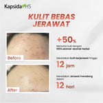 Kembang Bulan Kapsida HS 12 Kapsul FREE SCRUNCHIE KOREA - Obat Jerawat Gatal-gatal Kulit Bisul Alergi Bekas Jerawat Punggung dan Batu Ampuh untuk Kesehatan Kulit