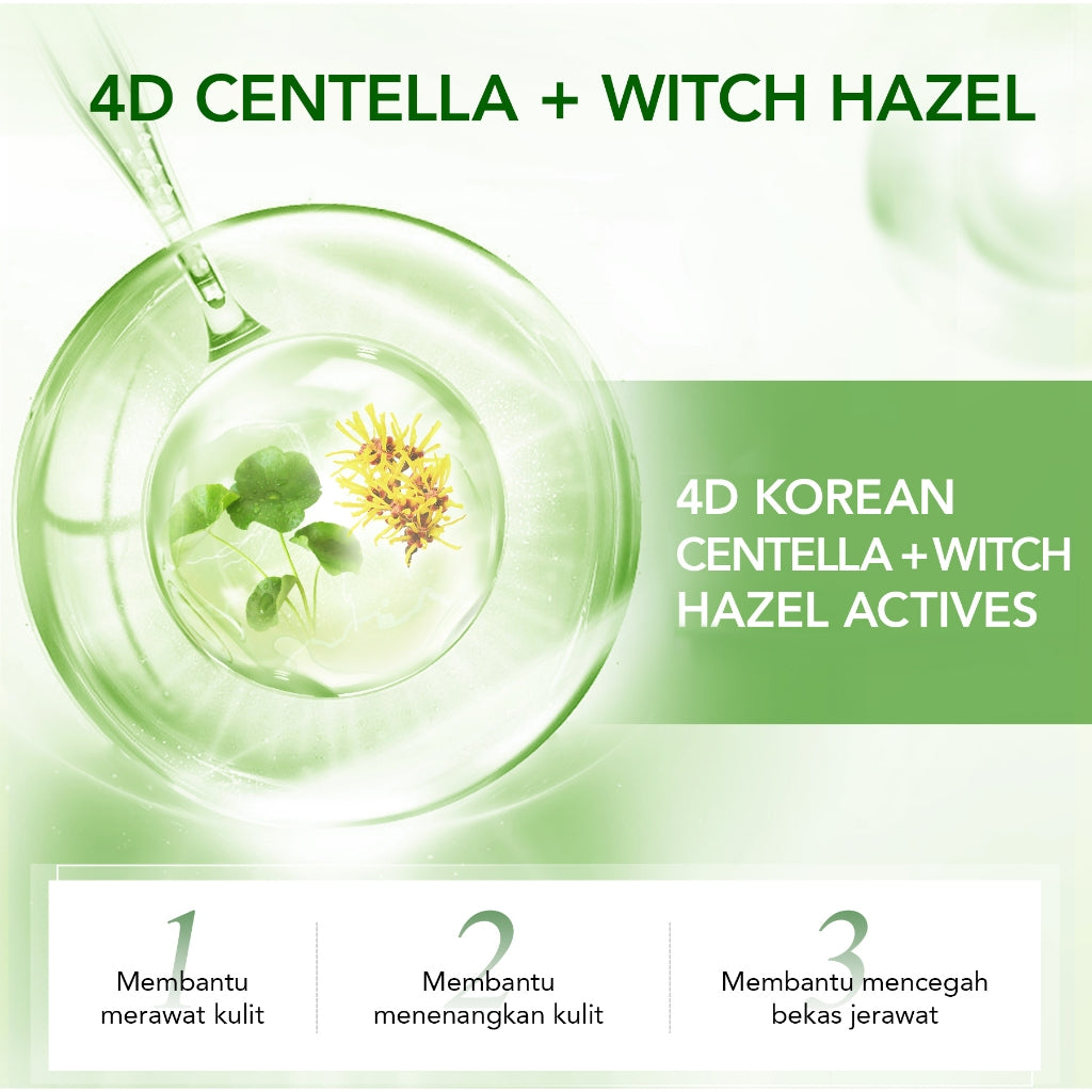 [NEW] YOU AcnePlus B5 Soothing Sheetmask Masker Jerawat dan Hydrating Bebas Jerawat