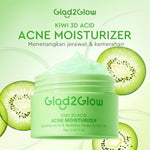 GLAD2GLOW Kiwi 3D Acid Acne Moisturizer Pelembab Wajah Jerawat Mencerahkan Pencerah Wajah&Penuaan Hilangkan Flek & Tenangkan Kulit Skincare Pelembab Esensi Wajah Perawatan Kulit Pelembab Wajah Pembersih day cream tone up g2g official store
