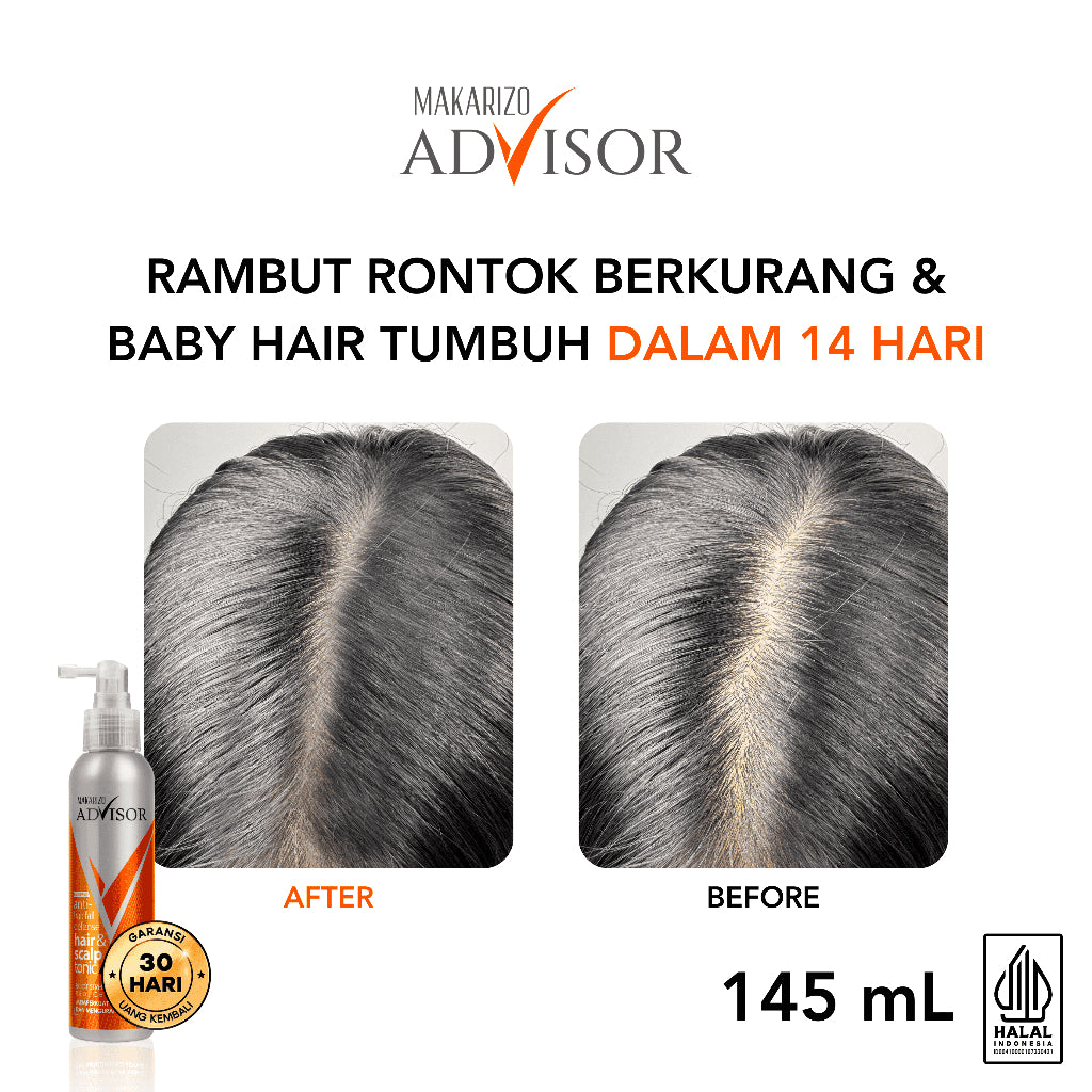 Makarizo Advisor Hair & Scalp Tonic 140 mL & 145mL - 2 in 1 Untuk Rambut Rontok dan Ketombe