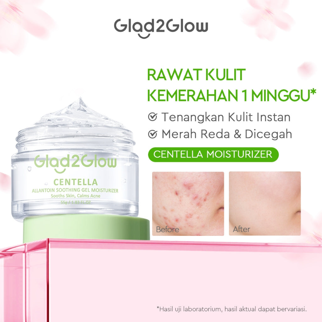 Glad2Glow Moisturizer Series Mencerahkan Pencerah Wajah Anti Jerawat Penuaan Hilangkan Flek Tenangkan Kulit Niacinamide 377 Retinol Centella Skincare Pelembab Esensi Perawatan Kulit Pelembab Wajah Pembersih day cream tone up g2g official store