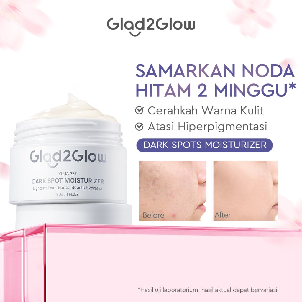 Glad2Glow Moisturizer Series Mencerahkan Pencerah Wajah Anti Jerawat Penuaan Hilangkan Flek Tenangkan Kulit Niacinamide 377 Retinol Centella Skincare Pelembab Esensi Perawatan Kulit Pelembab Wajah Pembersih day cream tone up g2g official store