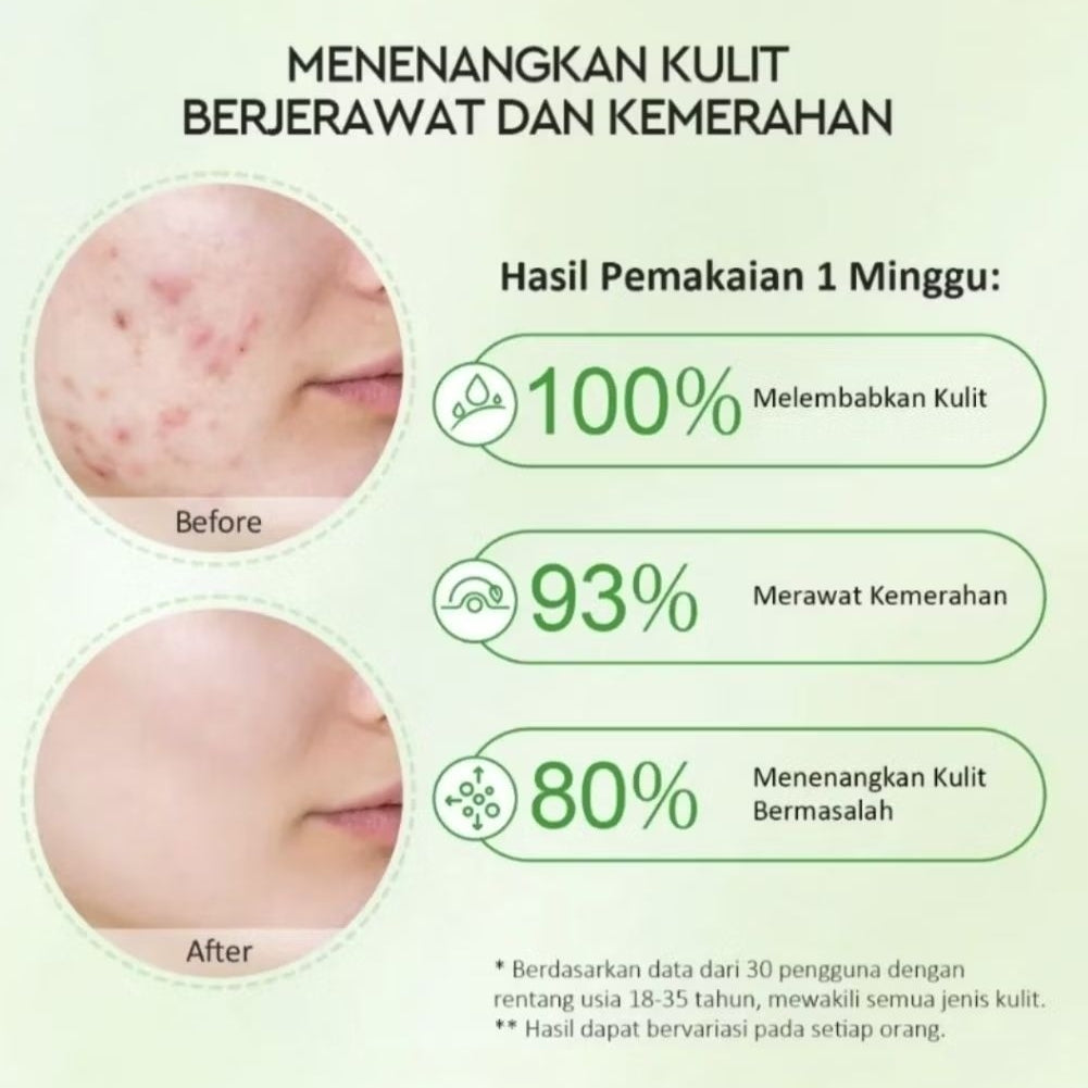 Glad2Glow Centella Gel Moisturizer Pelembap Wajah Anti Jerawat 55 g