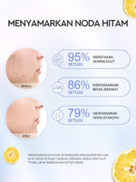 [ORDER NOW, HEMAT 30K]Glad2Glow Symwhite377 Dark Spot Bundle 7PCS-Yuja Skincare Cerah Brightening Moisturizer+Dark Spot Serum+Cleanser+Retinol Moisturizer+ Retinol Serum+Toner+Clay Stick Meringankan flek hitam mencerahkan warna kulit g2glow official store