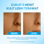 [SPESIAL OFFER] Cleora Beauty 3 Minutes Exfoliating Gel - Peeling Serum Membantu Mengangkat Kotoran & Sel Kulit Mati Mencerahkan Muka Exfoliasi Wajah Penghilang Dark Spot Skincare Acne Pria Wanita Eksfoliasi Muka Komedo With AHA BHA PHA Niacinamide Night