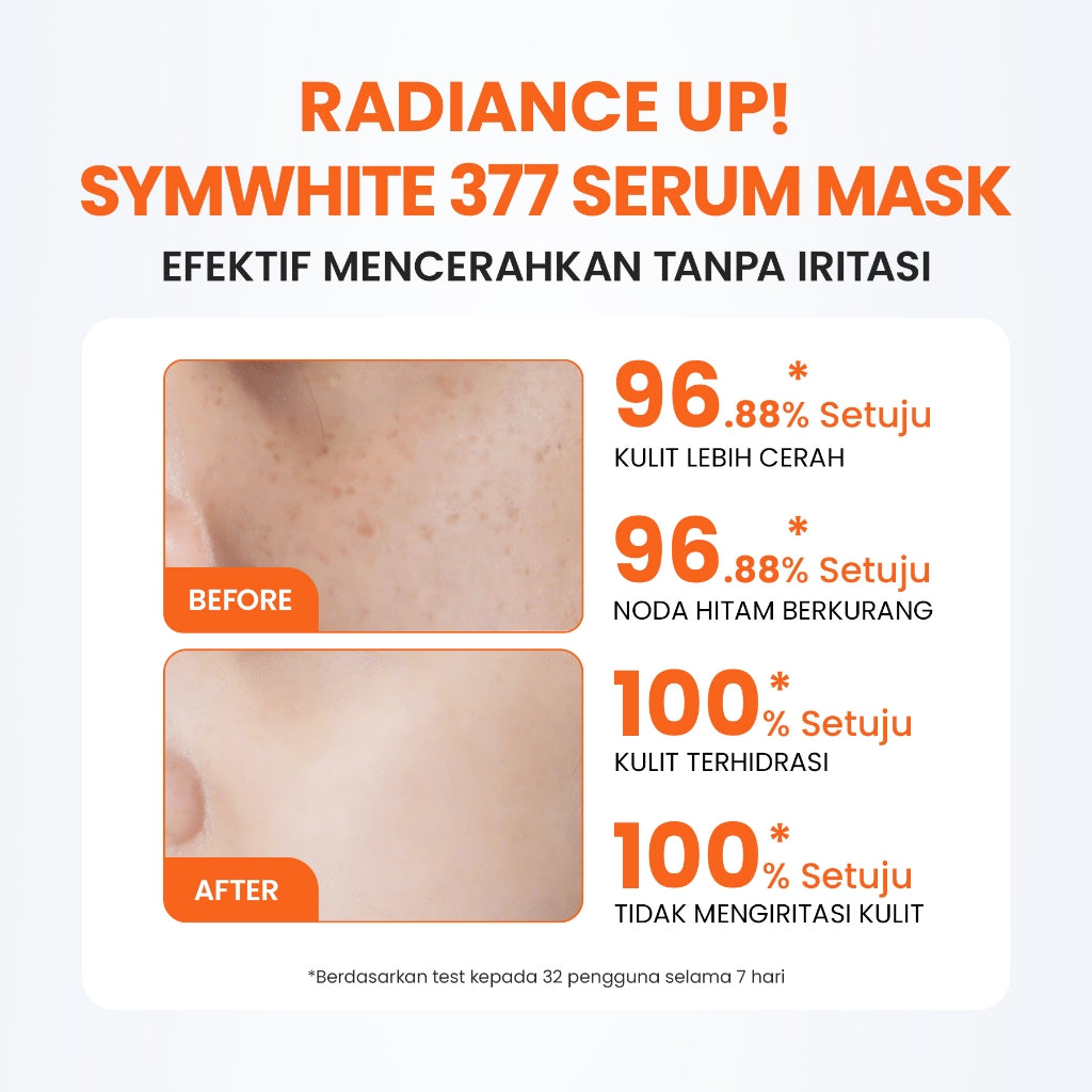 YOU Radiance Up! SymWhite 377 Serum Mask Masker Wajah Brightening Vitamin C Atasi Bekas Jerawat & Dark Spot