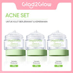 Glad2Glow Centella Water Gel Soothing Moisturizer Madeca Cream Berjerawat Acne Cica Pelembab Wajah 100g  Menenangkan kulit Mengurangi kemerahan Mengontrol minyak Mengobati kulit berjerawat Menjaga g2glow official store