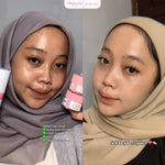 GLOGLOWING Glowing Night Acne Booster 10g
