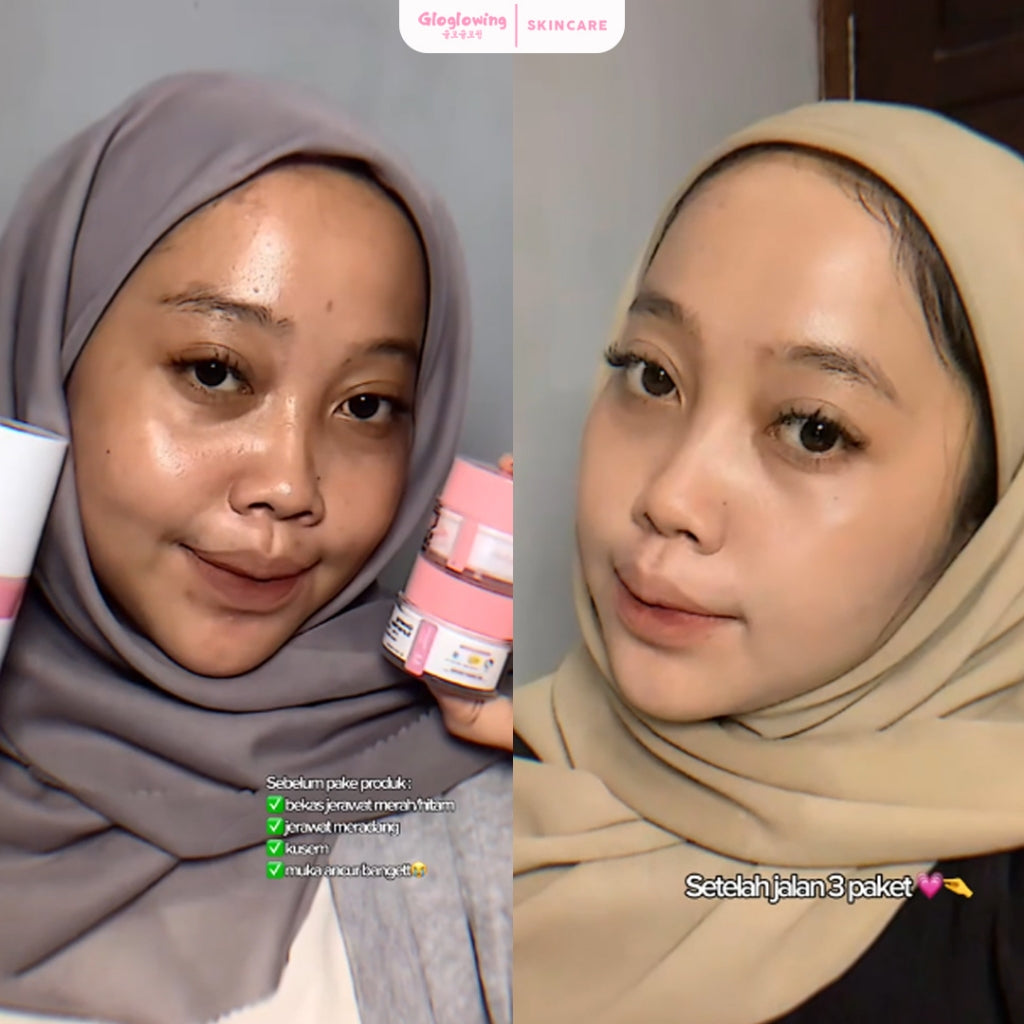 GLOGLOWING Glowing Night Acne Booster 10g
