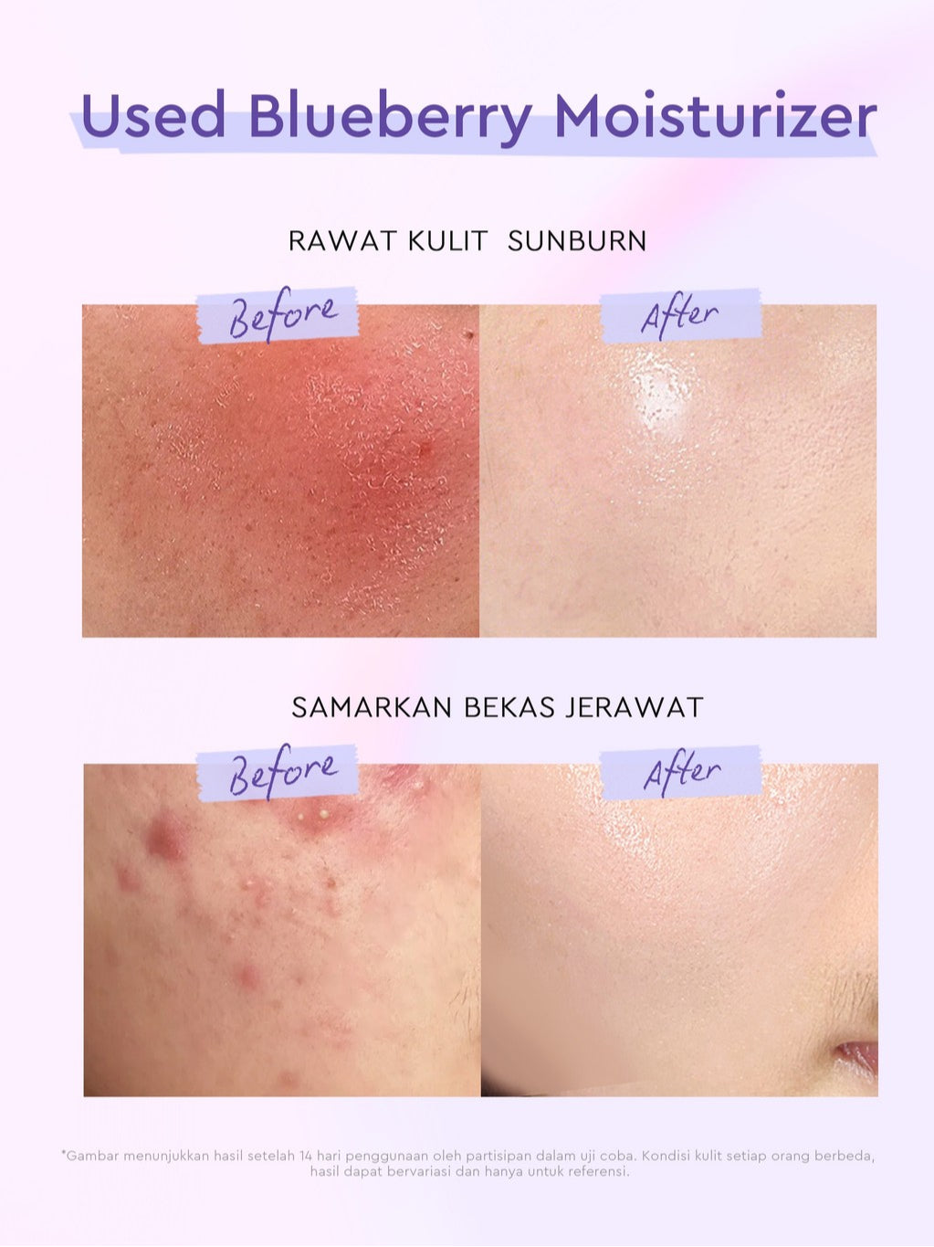 Glad2Glow Blueberry 5% Ceramide Moisturizer Repair Barrier Pulihkan skincare day cream Night Cream krim wajah moisturizer cream repair cream torriden cream cream pemutih wajah skincare bpom Pelembab Wajah Sensitive Skin Care G2G glad2glow official store