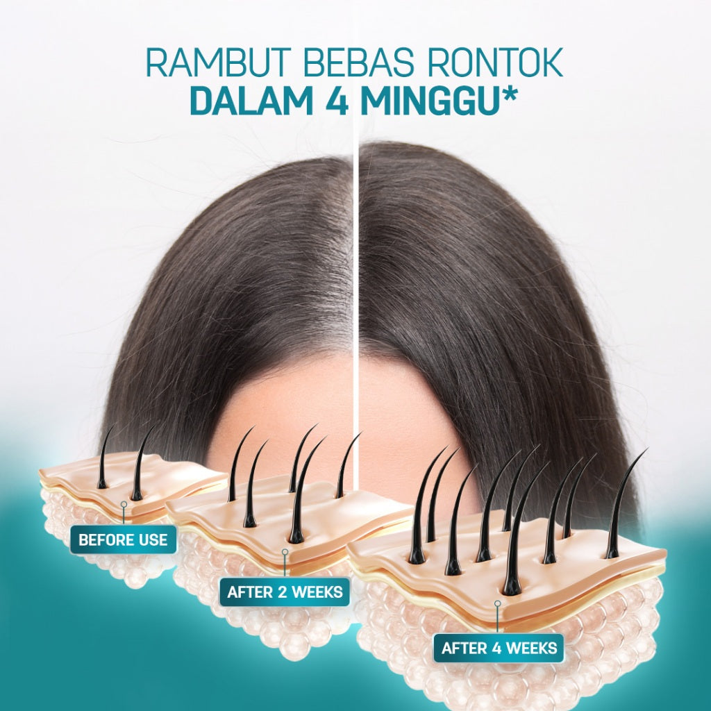 [BEST SELLER SHAMPOO HAIR FALL] ERHAIR HairGrow Shampoo NON SLS 370ml | Hair Shampoo | Sampo Rambut | Mengatasi rambut rontok kebotakan  | Panax Ginseng & Pumpkin Seed | DHT Blocker