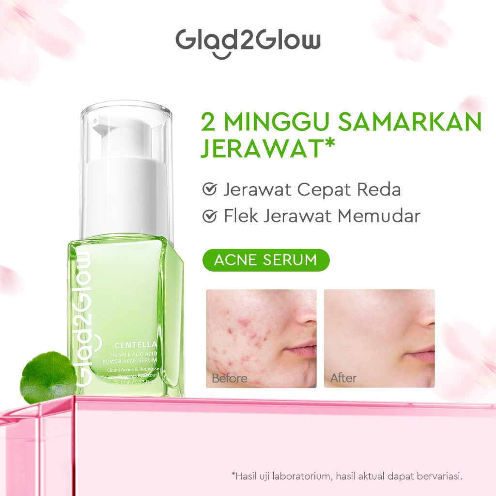 [Hemat 4PCS] Glad2Glow Serum Series - Brightening Mencerahkan Mengurangi Flek Menghaluskan Kulit Meratakan Warna Skincare Kulit Memudarkan Jerawat Niacinamide AHA BHA Centella 377 Perawatan Kulit Peeling Lembut Eksfoliasi Tidak Perih g2glow official store