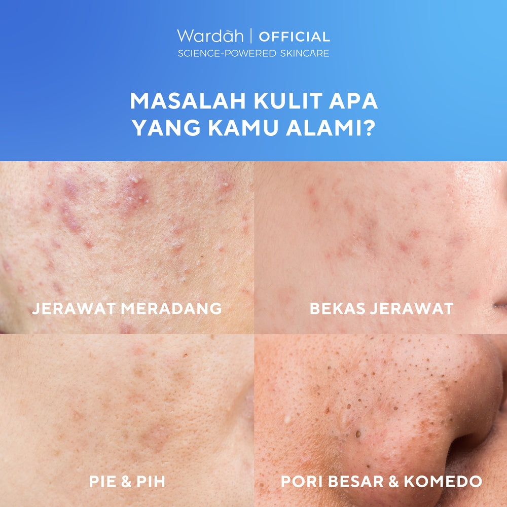 WARDAH UV Shield Acne Calming Sunscreen Serum SPF 50 PA 25ml 40 ml 100ml Sunscreen Wajah Meredakan Jerawat Ringan Mudah Meresap Calming and Repair Boosting Skincare