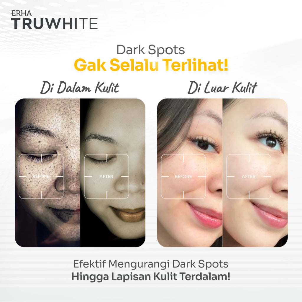 ERHA Truwhite Active Glow Booster with 3% Tranexamic Acid & Hexyl Resorcinol - 15ml I Atasi dan Cerahkan Dark Spot cocok untuk kulit Normal/Sensitif/Jerawat