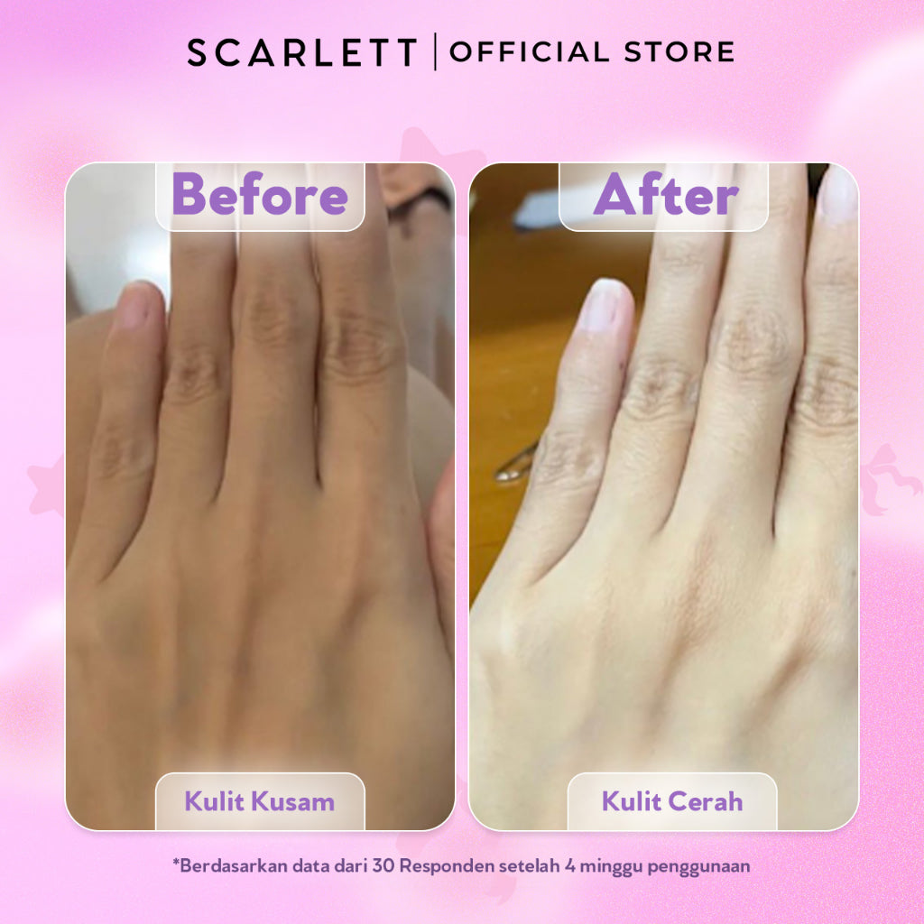 【NEW LAUNCH】BUNDLING Scarlett Fragrance Brightening Body Serum 170ml & Scarlett Whitening Extrait De Parfum 30ml ( Velvet Rouge / Purple Kiss )  | Melembapkan mencerahkan meratakan warna kulit, Kulit cerah wangi mewah