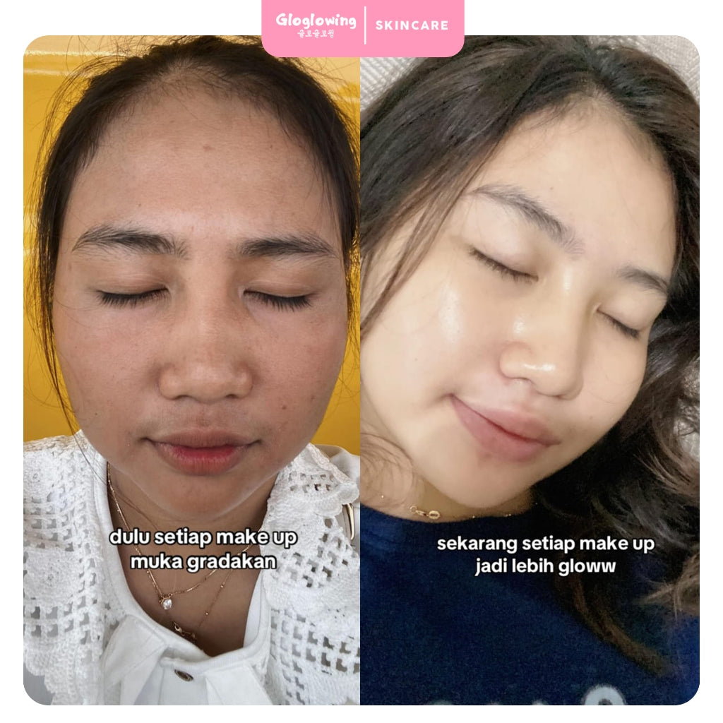 GLOGLOWING Day + Night Acne
