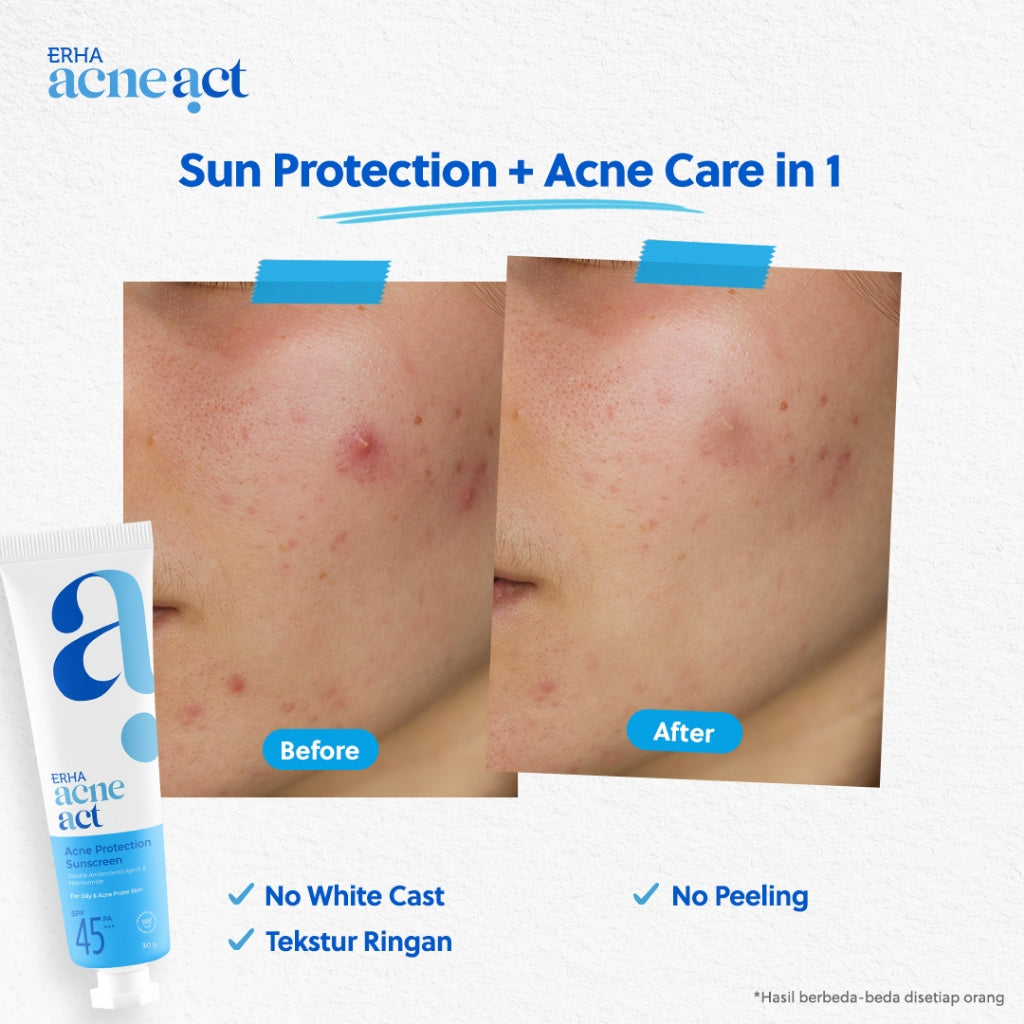 ERHA Acneact Acne Protection & Oil Control Sunscreen SPF 45+++ 30 g Sunscreen Jerawat Niacinamide
