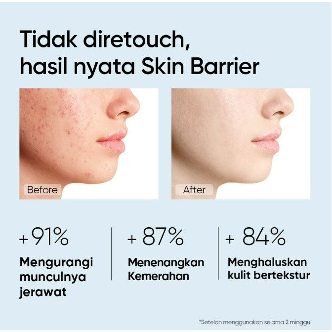 SKINTIFIC 5X Ceramide Barrier / Niacinamide Moisturizer Gel 6g TRAVEL SIZE | Cream Pemutih Wajah Calming Whitening Brightening Dark Spot