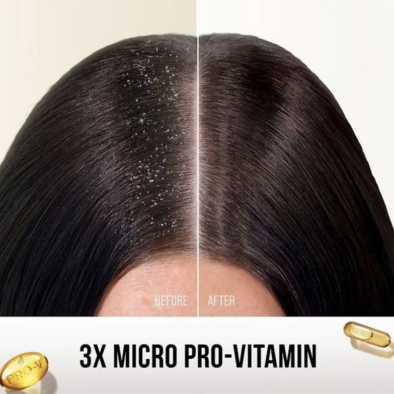 Pantene Shampo Perawatan Rambut 160 Ml Efektif