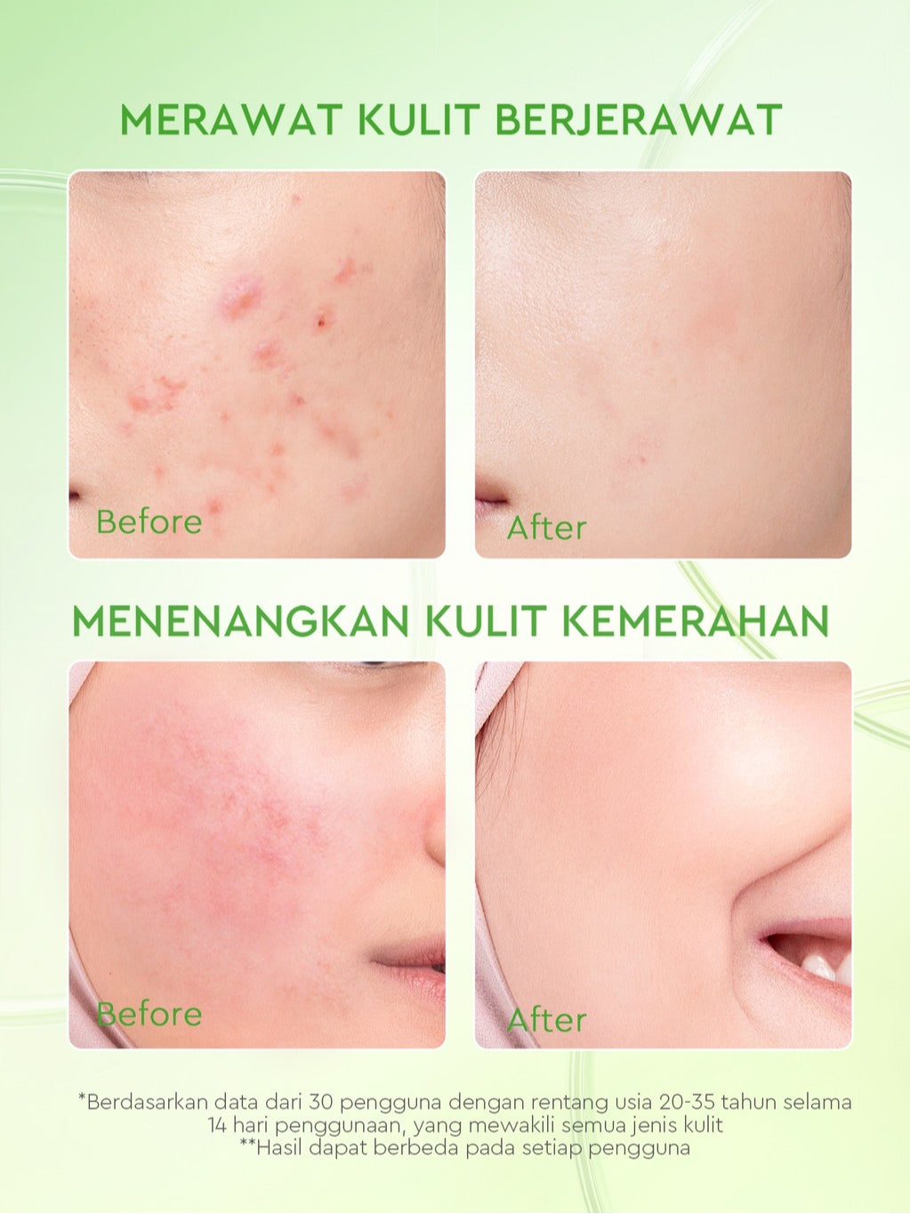 GLAD2GLOW Kiwi 3D Acid Acne Moisturizer Pelembab Wajah Jerawat Mencerahkan Pencerah Wajah&Penuaan Hilangkan Flek & Tenangkan Kulit Skincare Pelembab Esensi Wajah Perawatan Kulit Pelembab Wajah Pembersih day cream tone up g2g official store