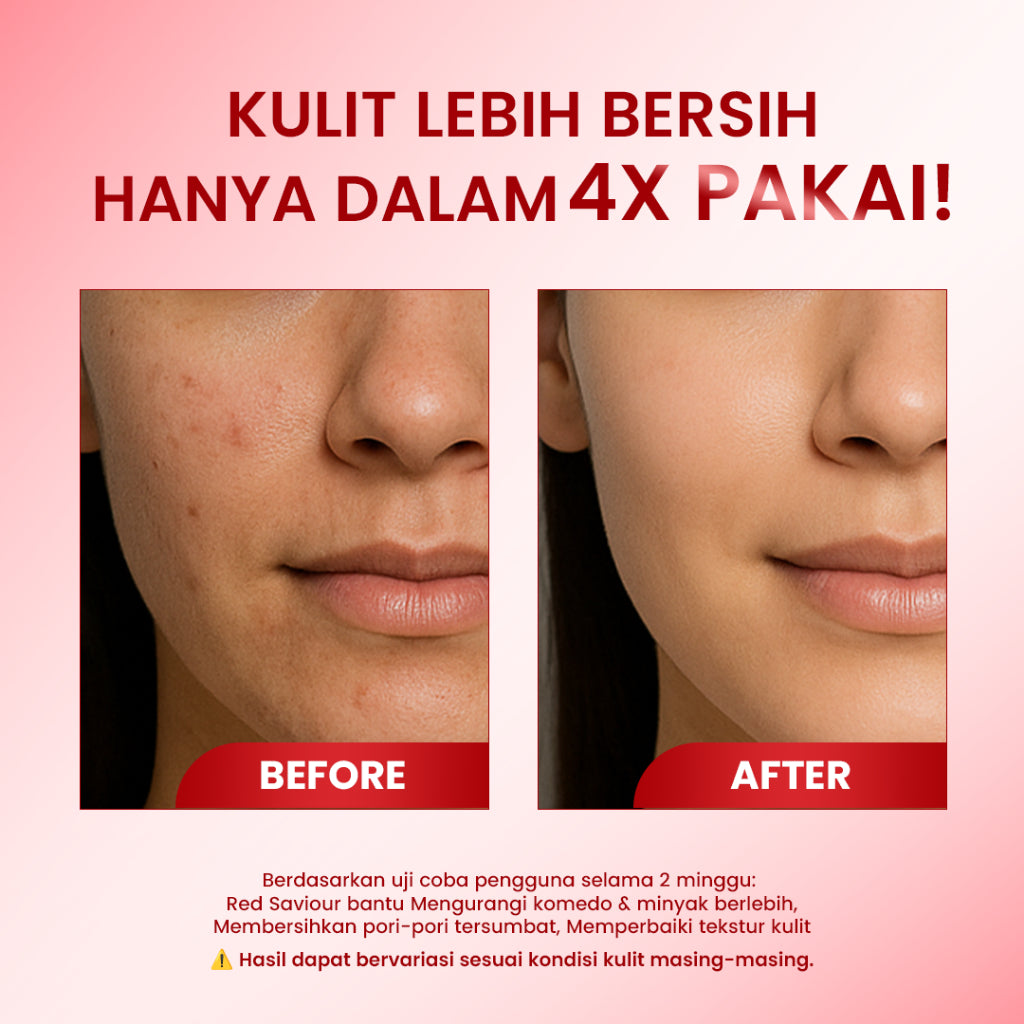 [HOT SALE] Cleora Beauty Peeling Solution Serum - Red Saviour AHA BHA PHA Eksfoliasi Wajah Berminyak Kusam Mencerahkan Skincare Acne Dan Komedo Dark Spot Brightening Mengangkat Sel Kulit Mati Scincare Mugwort Exfoliasi Perawatan Kulit Pria dan Wanita BPOM