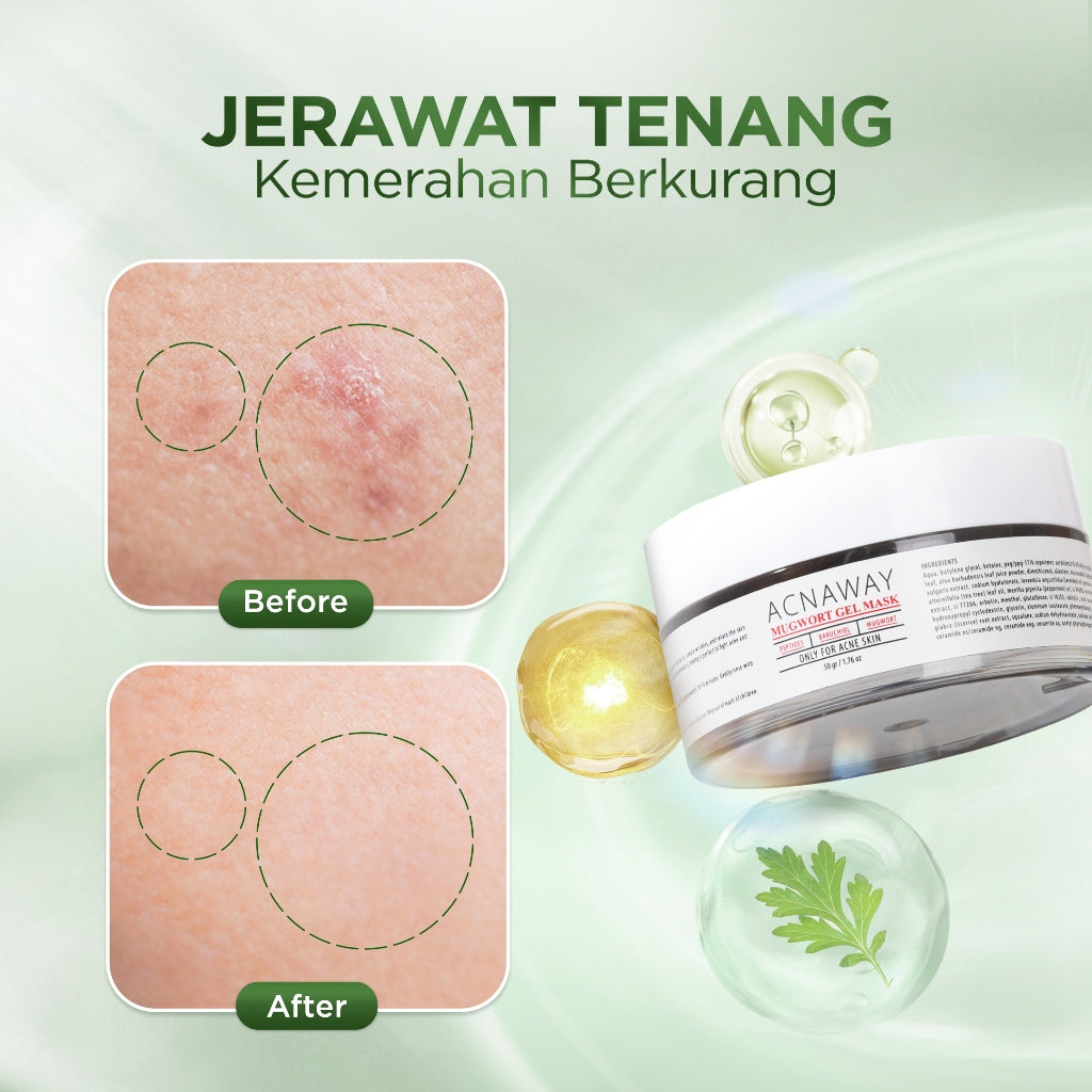 ACNAWAY Advanced Mugwort Gel Mask – Face Mask Gel Masker Wajah untuk Kulit Berjerawat | Mencerahkan, Menghaluskan & Membersihkan Pori | Anti Kusam, Komedo & Minyak | Acne Skincare Brightening & Pore Care Masker Komedo Sleeping Mask Masker jerawat Acne Mas