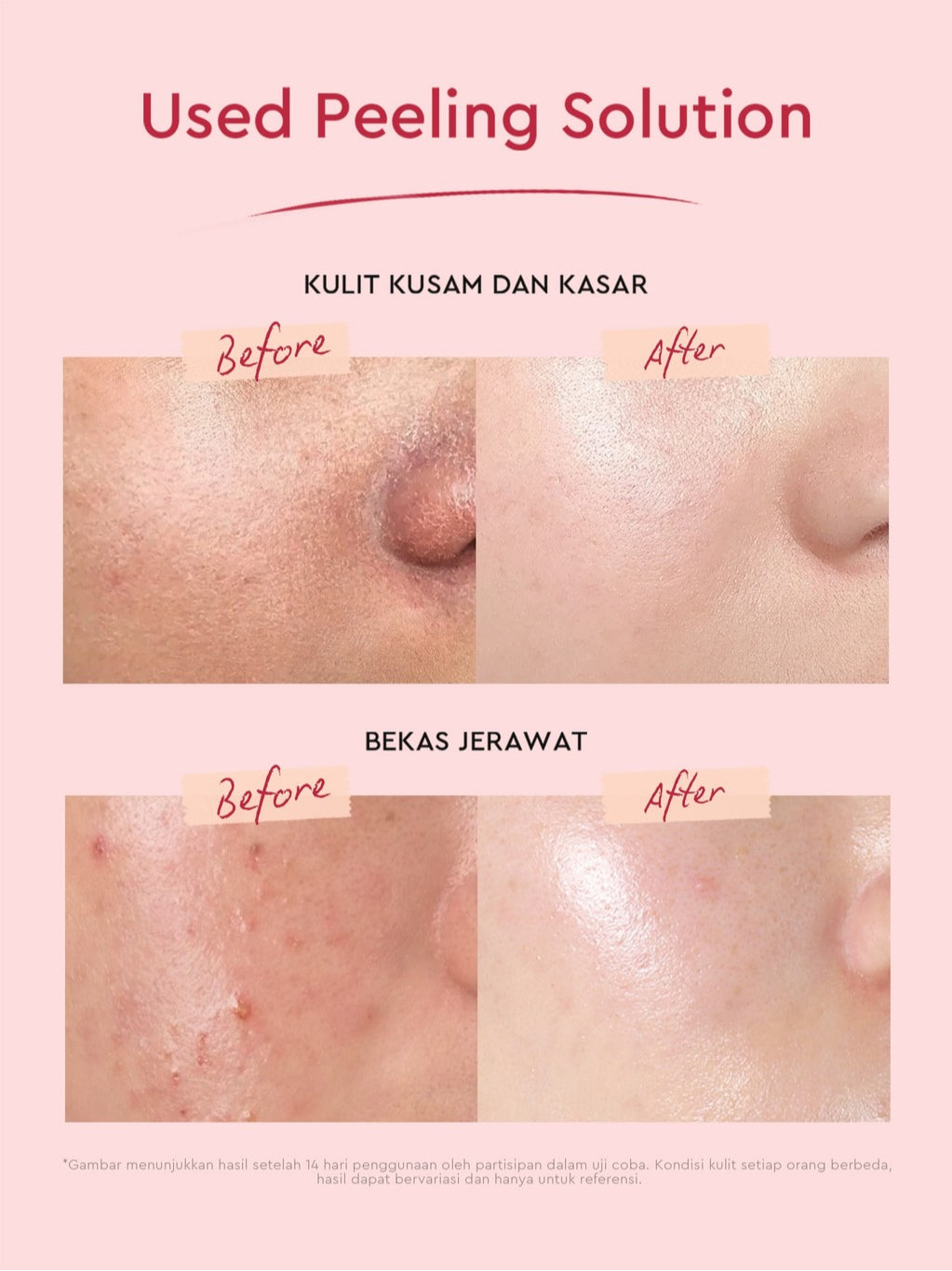 Glad2Glow Peeling Solution Serum Eksfoliasi Wajah 60S Menghaluskan Kulit Anda AHA BHA PHA Intensive serum vitamin c serum wajah white serum wajah glowing dan putih peeling exfoliating serum niacinamide Bahkan warna kulit kulit halus g2glow official store